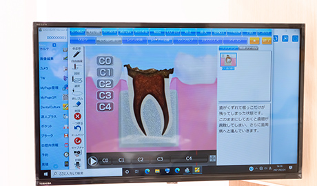 説明用モニター