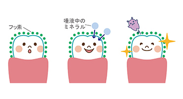 フッ素塗布